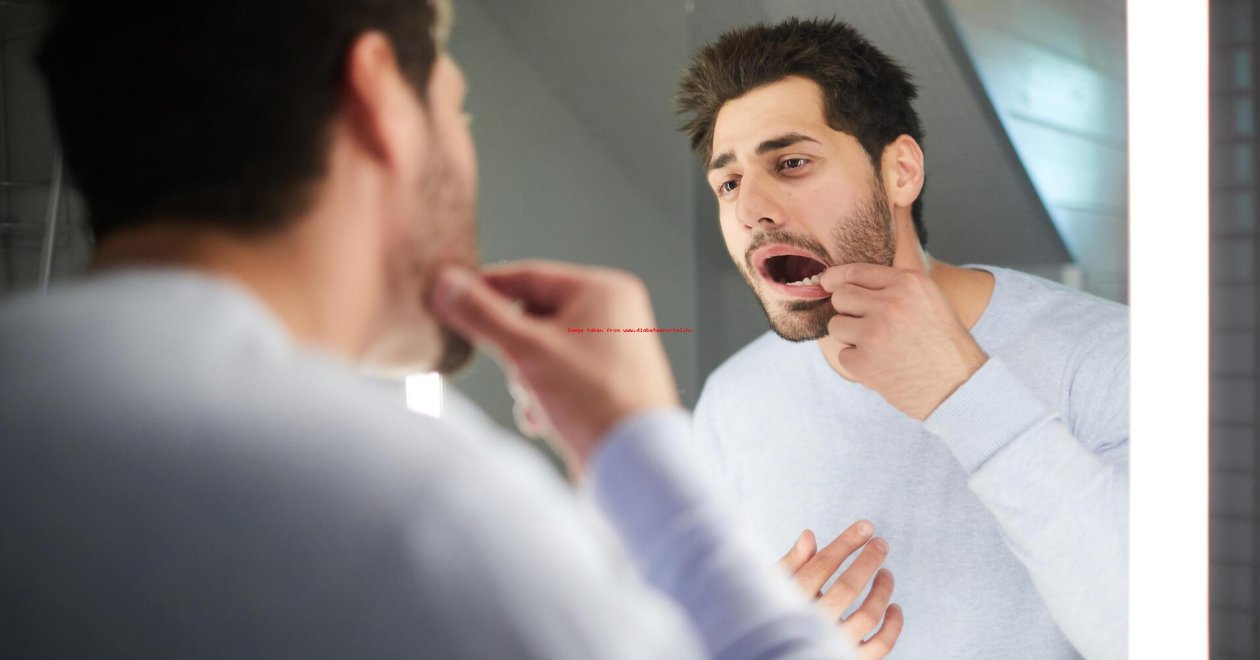 Ezért gyakoribb a fogvesztés a cukorbetegeknél