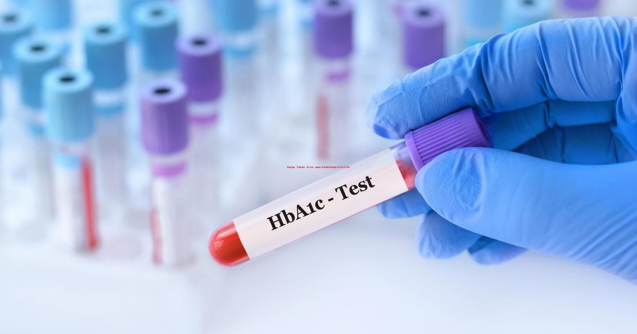 Mit jelent, ha magas a HbA1c érték a leleten?