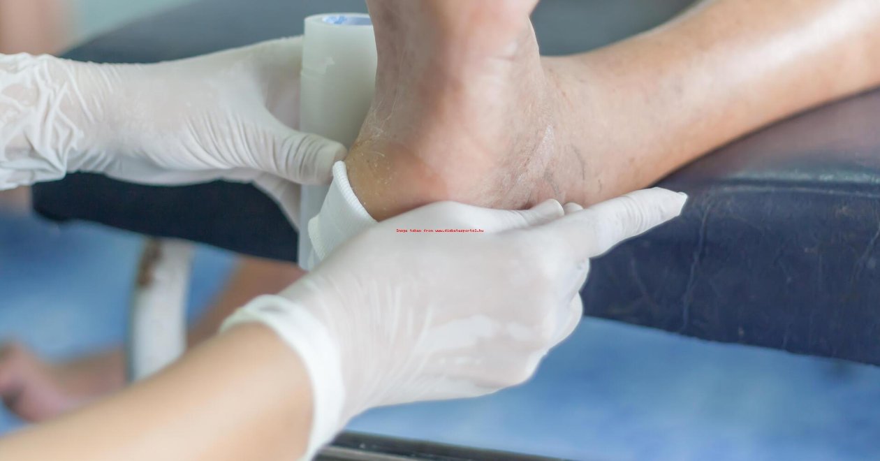 Cukorbetegség okozta fekély - Minden amit érdemes tudnod!