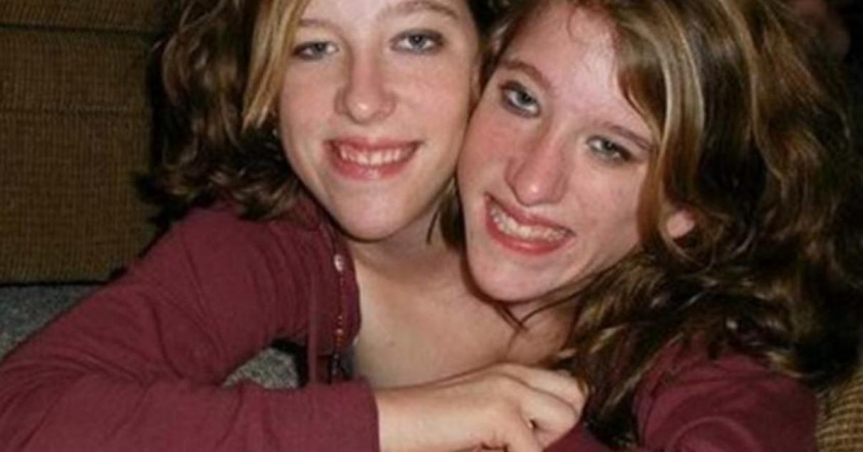 Egy sziámi ikerpár mindennapjai 