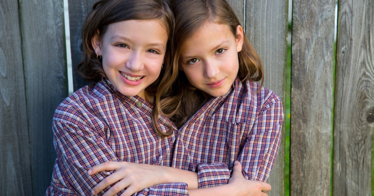 A leghíresebb magyar sziámi ikerpár