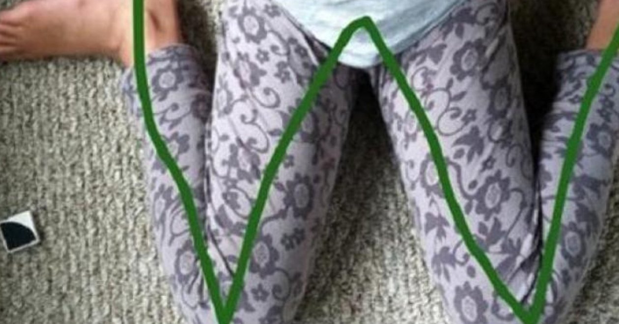 Későbbi károkat okoz ez a pozíció a gyerekeknél