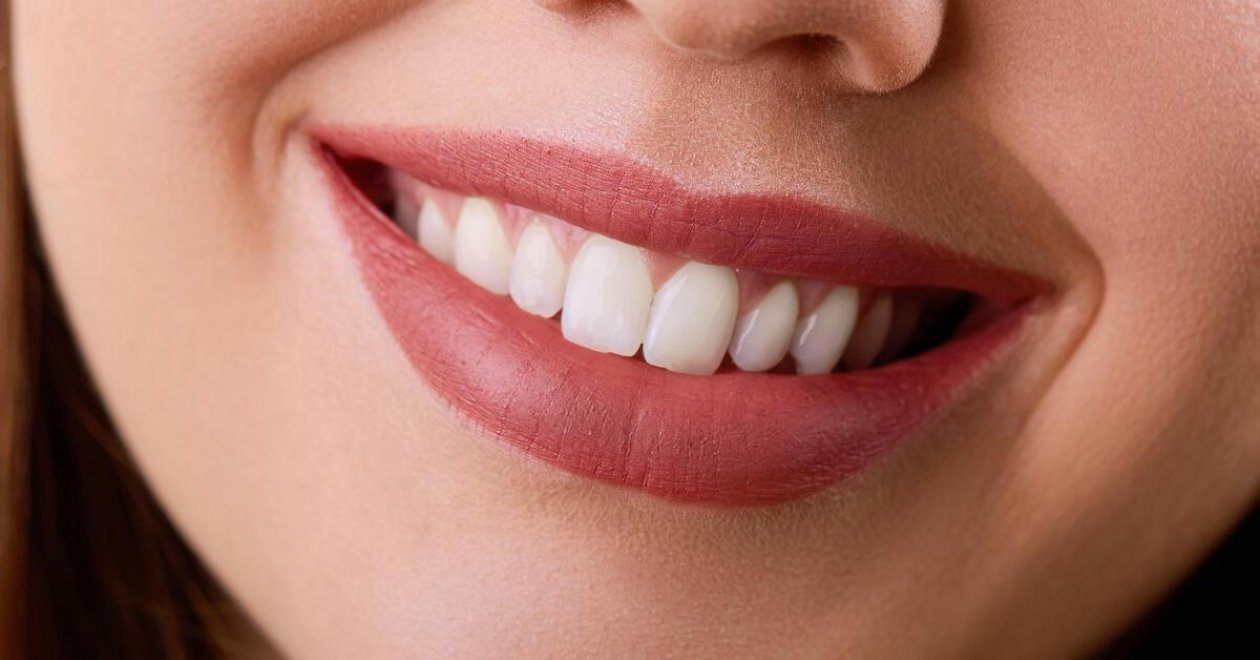 5 legnagyobb tévhit a cirkon fogkoronáról