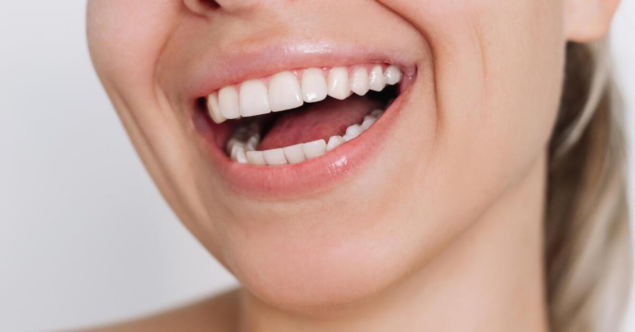 5 probléma, amin segíthet a kozmetikai fogászat