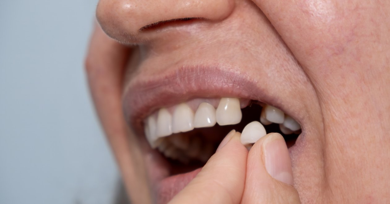 Miért romlik a rágás és az emésztés egy hiányzó fog miatt?